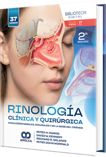 Rinología clínica y quirúrgica. Patologías nasales, sinusales y de la base del cráneo