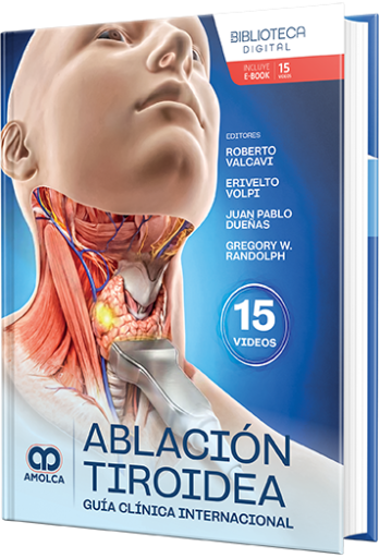 Ablación tiroidea. Guía clínica internacional