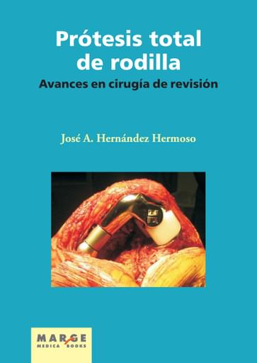 Prótesis total de rodilla