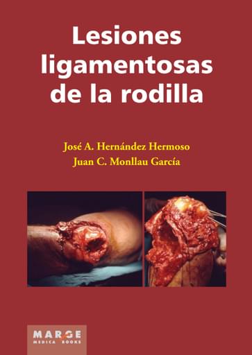 Lesiones ligamentosas de la rodilla
