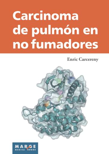 Carcinoma de pulmón en no fumadores