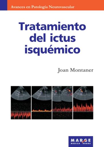 Tratamiento del ictus isquémico
