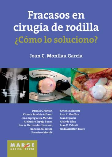 Fracasos en cirugía de rodilla ¿Cómo lo soluciono?