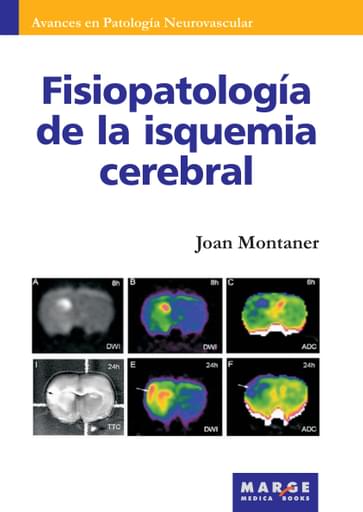 Fisiopatología de la isquemia cerebral