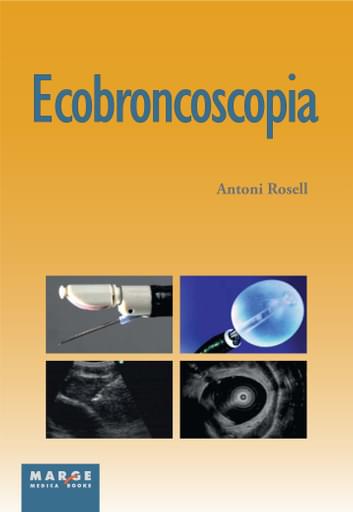 Ecobroncoscopia