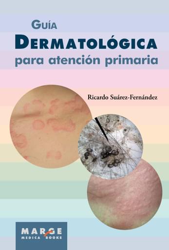Guía dermatológica para atención primaria