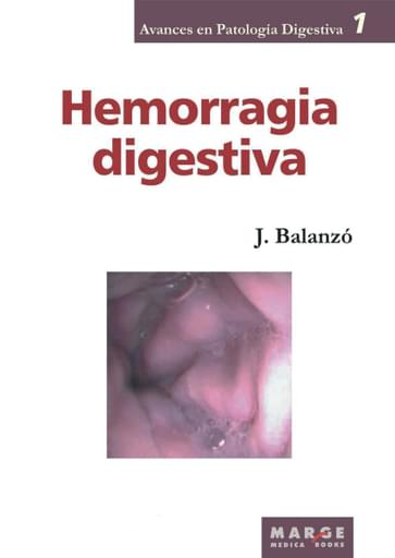 Hemorragia digestiva