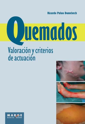 Quemados Valoración y criterios de actuación