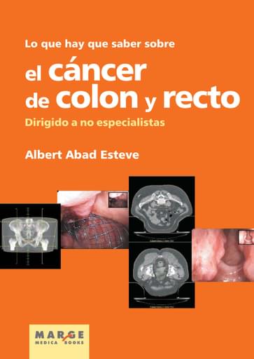 Lo que hay que saber sobre el cáncer de colon y recto Dirigido a no especialistas