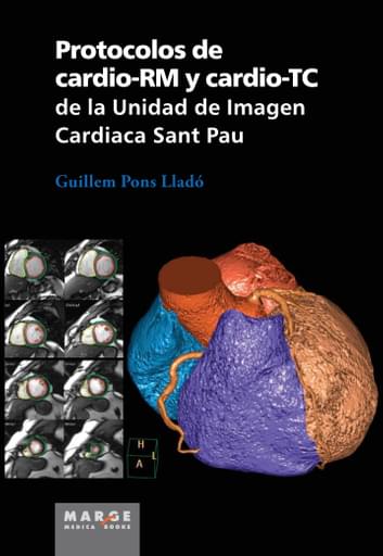 Protocolos de cardioRM y cardioTC de la Unidad de Imagen Cardiaca Sant Pau
