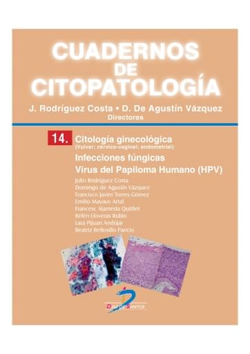 Portada del libro «Citología ginecológica. infecciones fúngicas. virus del papiloma humano», de Costa