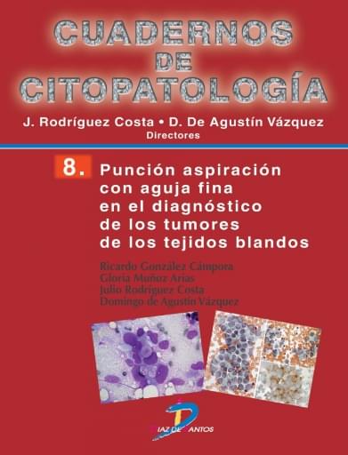 Punción aspiración con aguja fina en el diagnostico de los tumores de los tejidos blandos