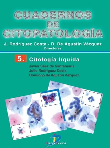 Portada del libro «Citología liquida», de Santamaria