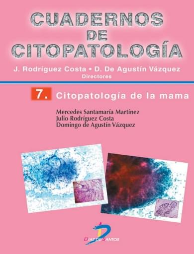Portada del libro «Citopatología de la mama», de Santamaria
