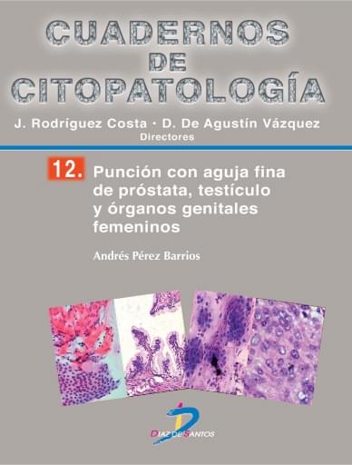 Punción con aguja fina de próstata, testículo y órganos genitales femeninos