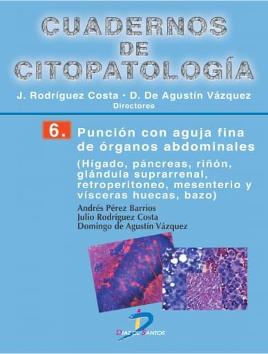 Punción con aguja fina de órganos abdominales