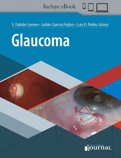 Glaucoma