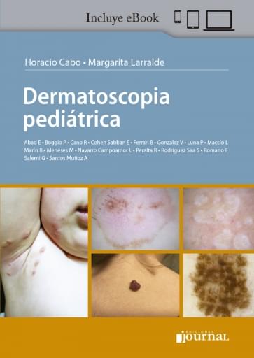 Dermatoscopia pediátrica