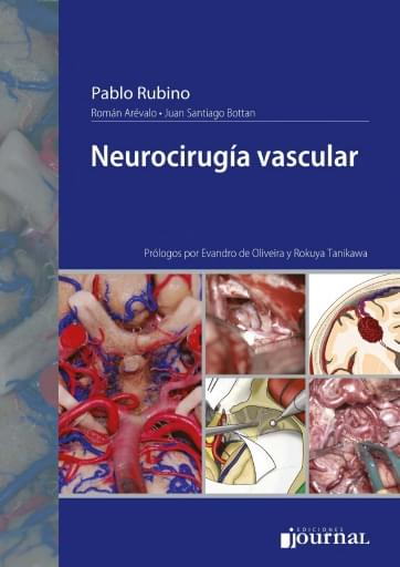 Neurocirugía vascular