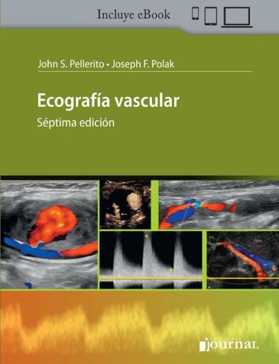 Ecografía vascular
