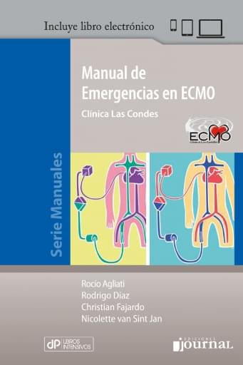 Manual de emergencias en ECMO