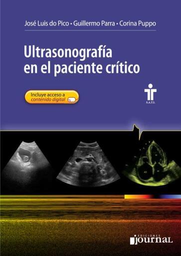 Ultrasonografía en el paciente crítico