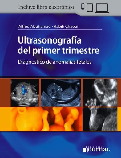 Ultrasonografía del primer trimestre