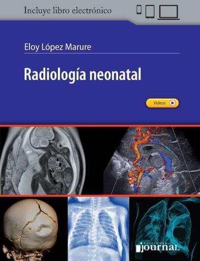 Radiología neonatal