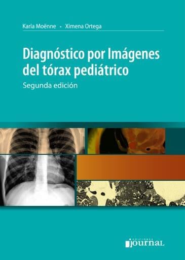 Diagnóstico por Imágenes del tórax pediátrico