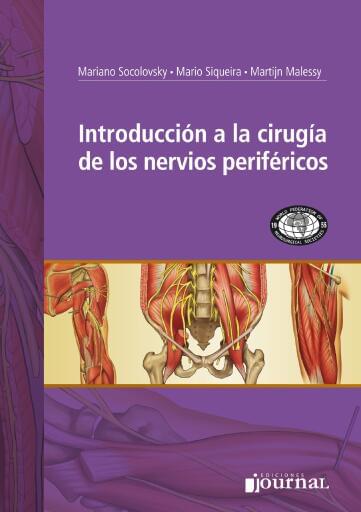Introducción a la cirugía de los nervios periféricos