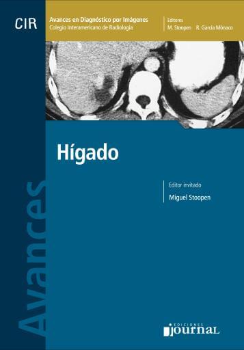 Hígado