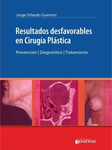 Resultados desfavorables en Cirugía Plástica