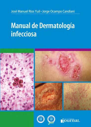Manual de dermatología infecciosa