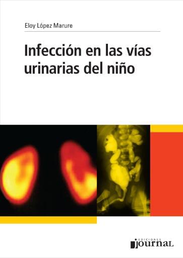 Infección en las vías urinarias del niño