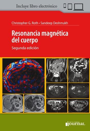 Resonancia magnética del cuerpo 2ª ed.
