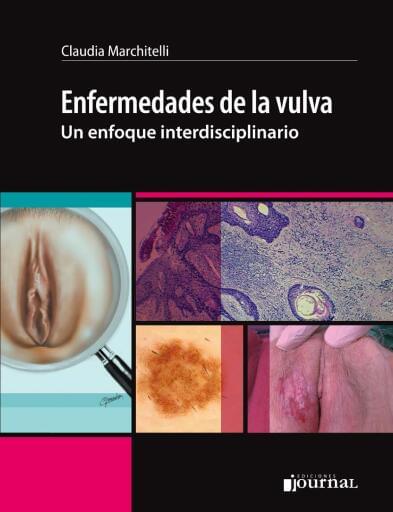 Enfermedades de la vulva