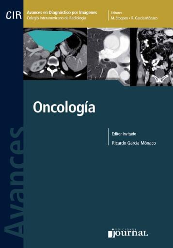 Oncología
