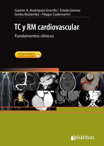 TC y RM cardiovascular