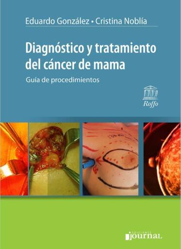 Diagnóstico y tratamiento del cáncer de Mama
