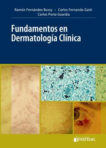 Fundamentos en Dermatología Clínica