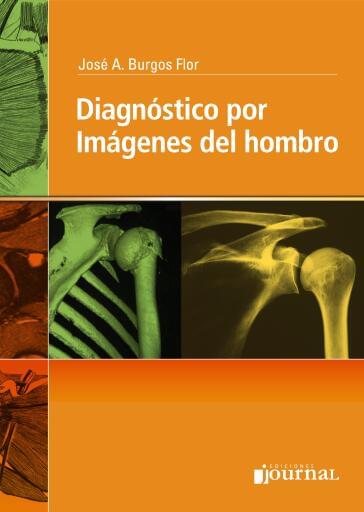 Diagnóstico por imágenes del hombro