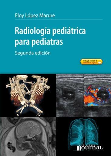 Radiología pediátrica para pediatras 2ª ed.