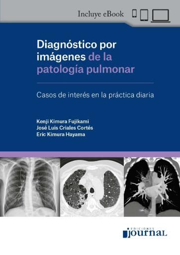 Diagnóstico por imágenes de la patología pulmonar