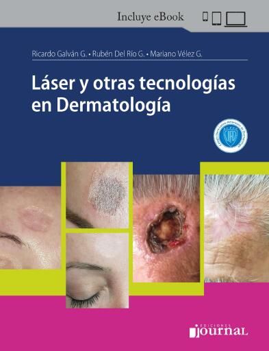 Portada del libro «Láser y otras tecnologías en Dermatología», de Ricardo Galván García, Rubén Del Río Gil