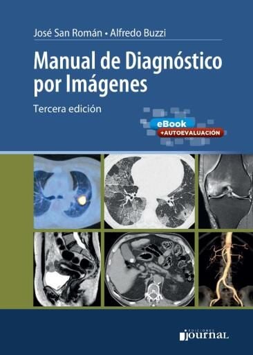 Manual de diagnóstico por imágenes 3ª ed.