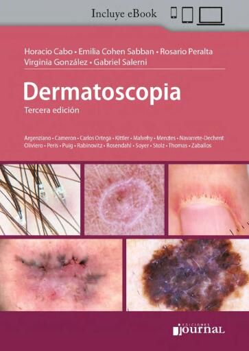 Dermatoscopia  3ª ed.