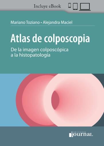 Portada del libro «Atlas de colposcopia», de Mariano Toziano