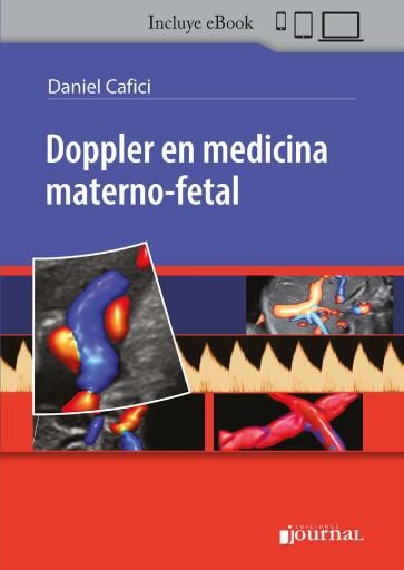 Doppler en medicina materno fetal