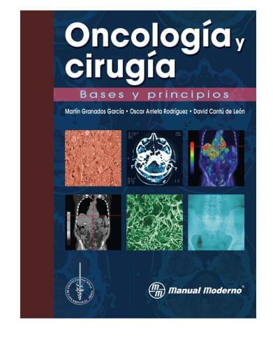 Oncología y cirugía: bases y principios