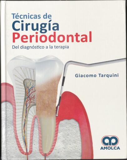 Técnicas de cirugía periodontal del diagnóstico a la terapia